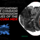 Understanding the Common Transmission Issues of the 2005 Acura MDX